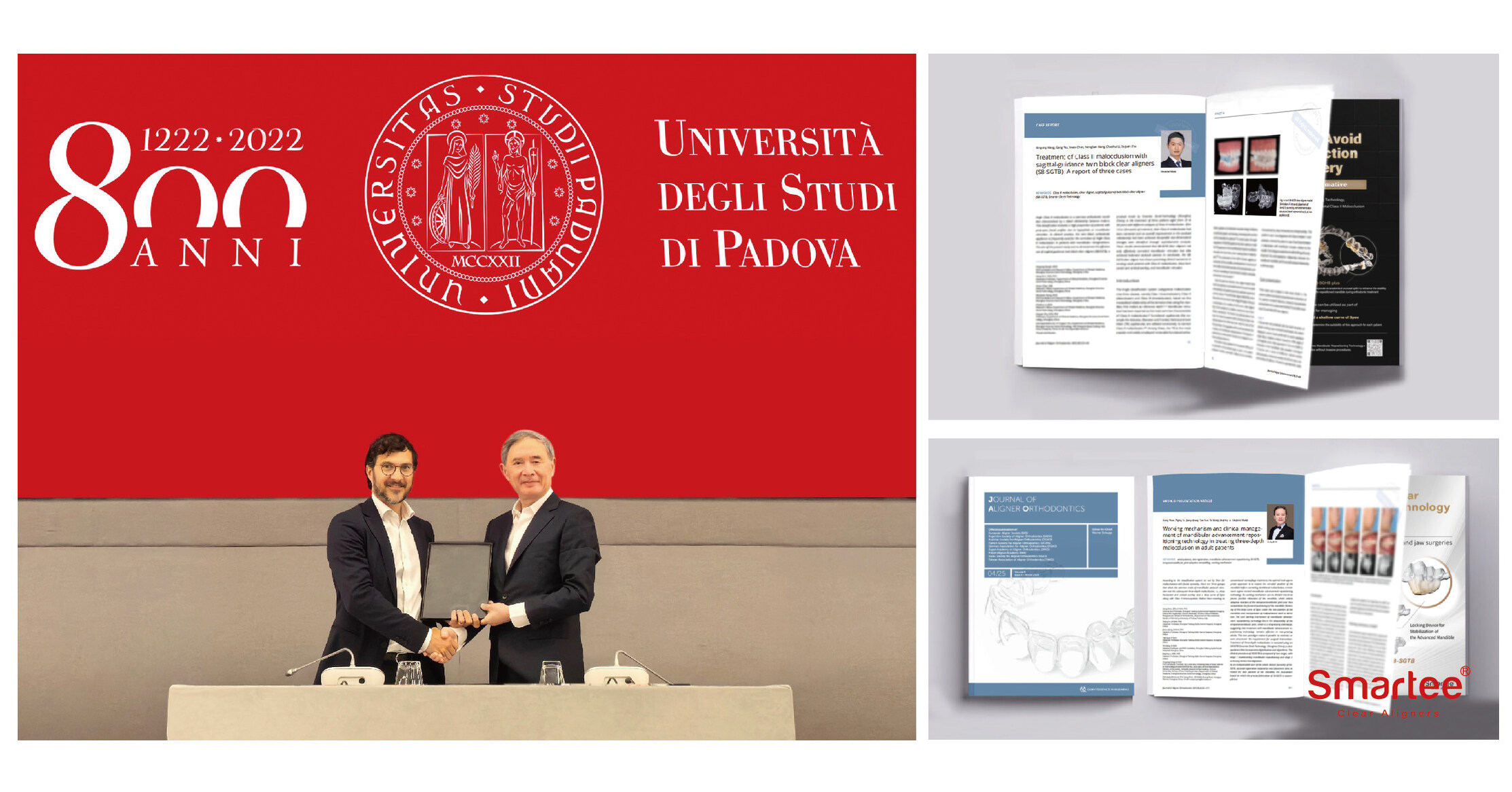 100,000 GS Mandibular Repositioning Cases: Worldwide Expansion and Increased Production Capacity